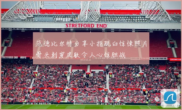 范德比尔特分享小指脱臼惊悚照片骨头刺穿皮肤令人心惊胆战
